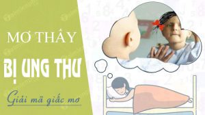 nam-mo-bi-ung-thu-danh-con-gi-la-diem-gi
